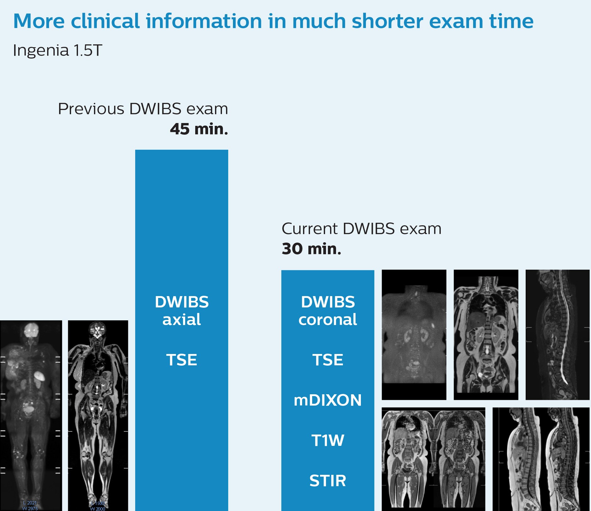 faster whole body mri kawasaki