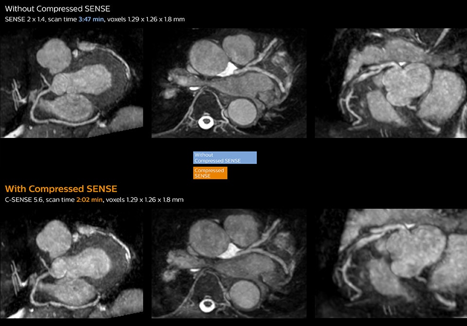 clinical image whole heart mri compressed sense desktop