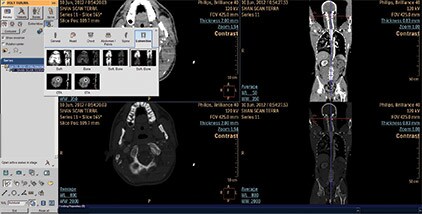 ct-acute-multifunctional-review-amfr