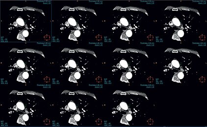 ct-cardiac-viewer