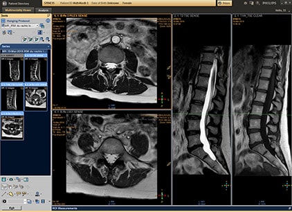 multi-modality-viewer-mmv