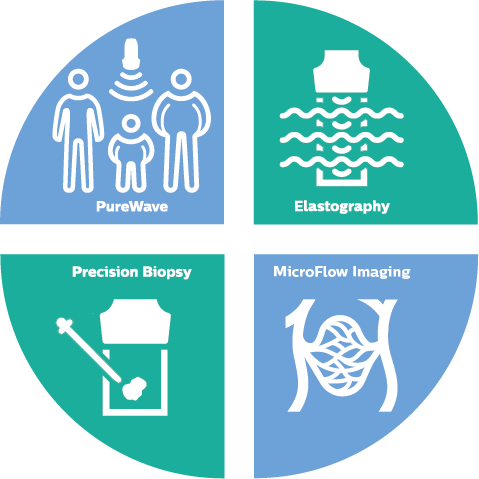 Small parts infographic