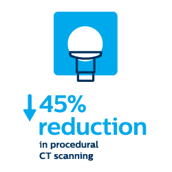 Reduction in procedural CT scan