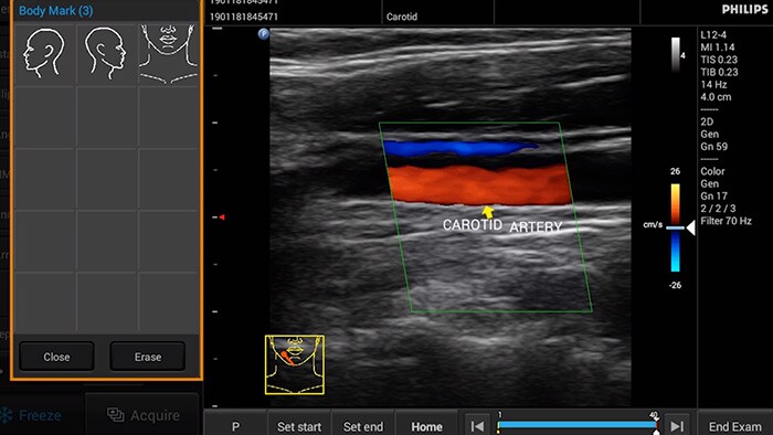 Annotation and Bodymarker