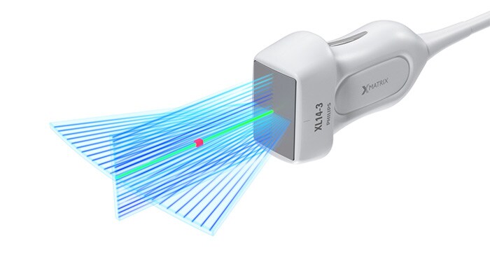 The Philips XL14-3 xMATRIX linear array transducer vascular ultrasound with xPlane Doppler